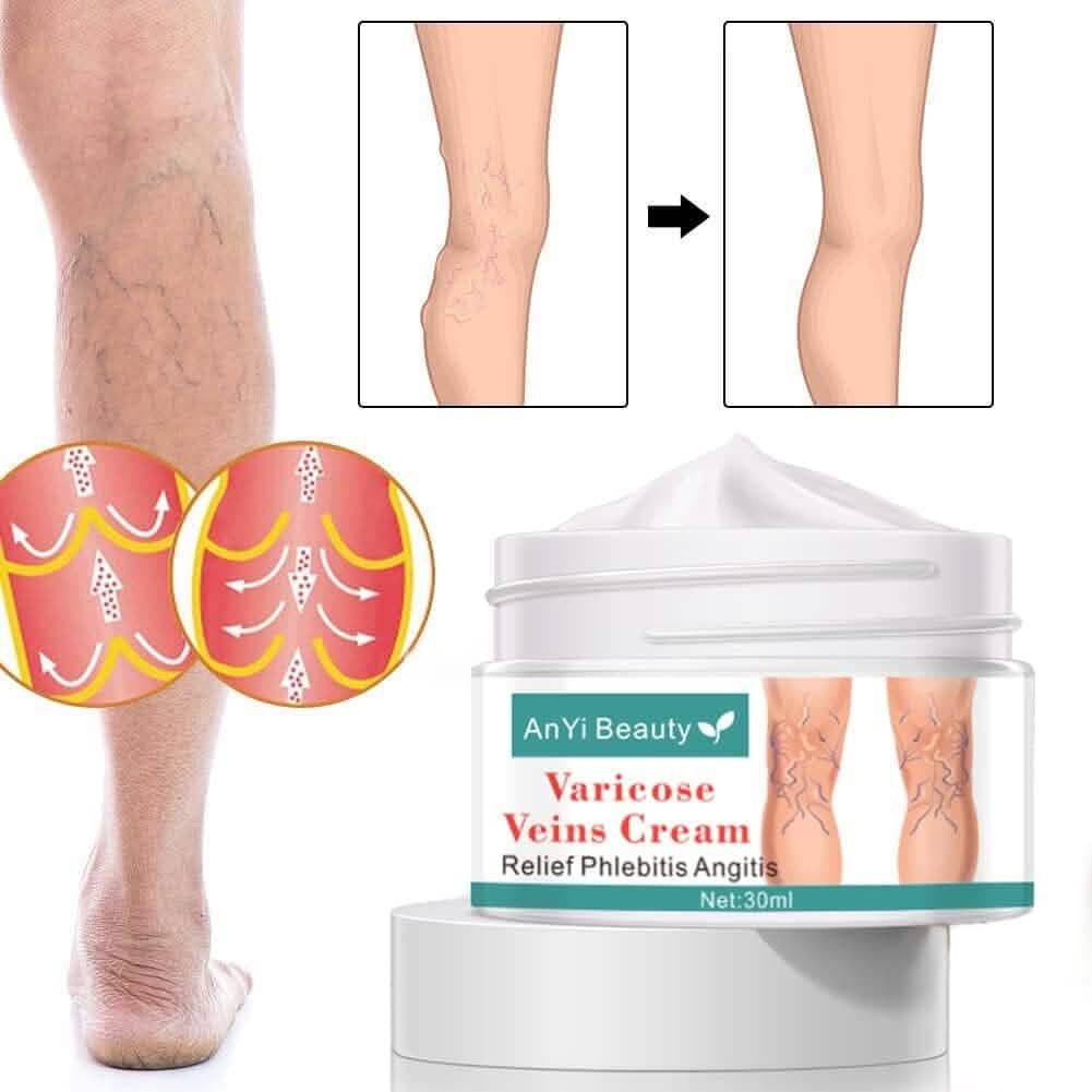 Varicose Deep Nourishing Soothing Vein Cream DailySale