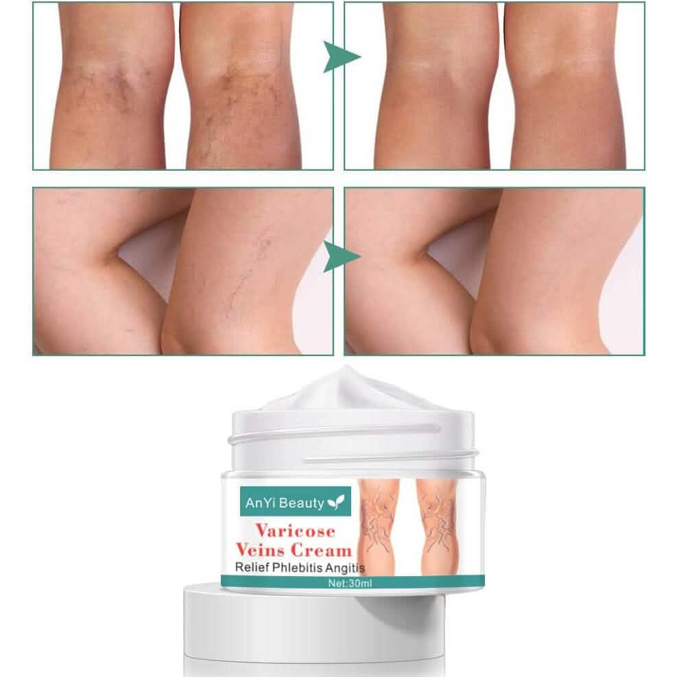 Varicose Deep Nourishing Soothing Vein Cream DailySale