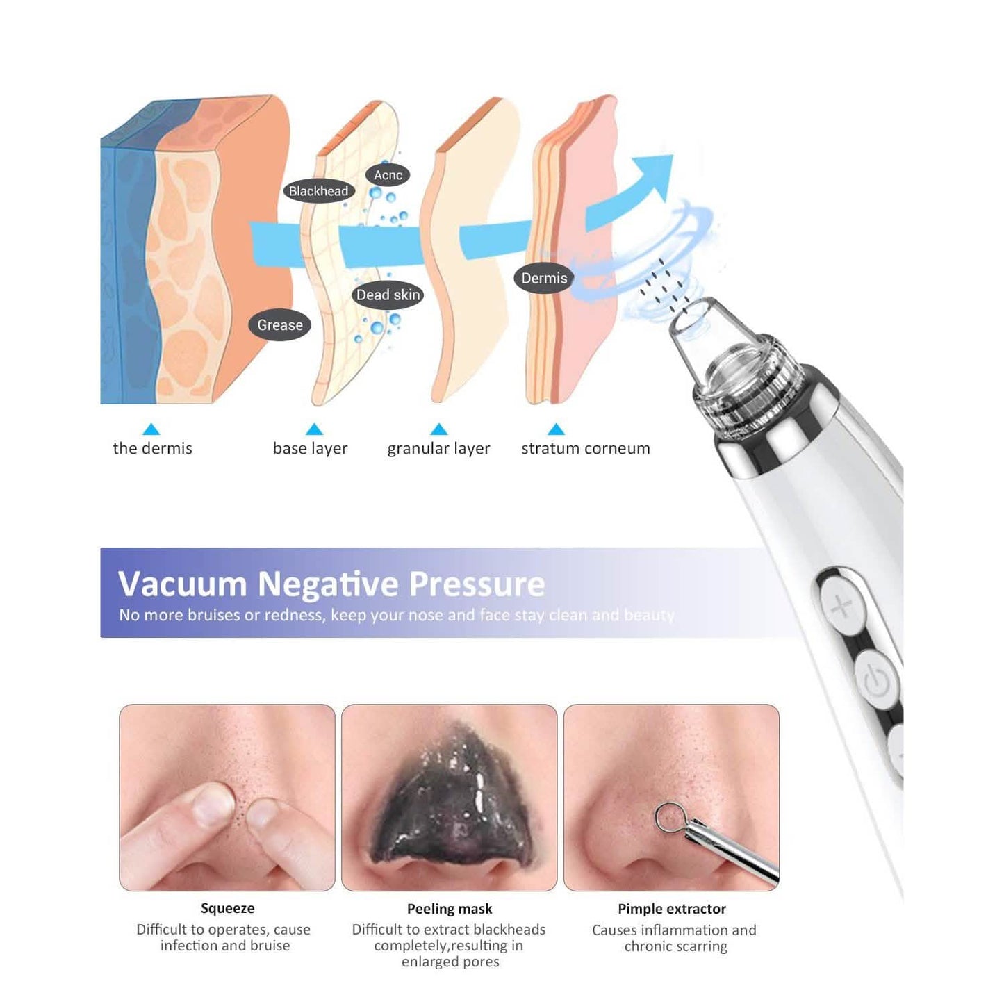Blackhead Pore Vacuum Cleaner Remover DailySale