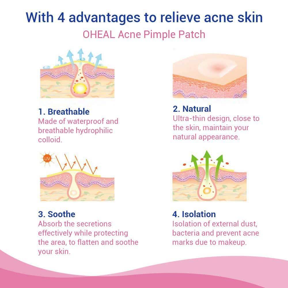 Blemish and Acne Treatment Skin Healing Spot Patches DailySale