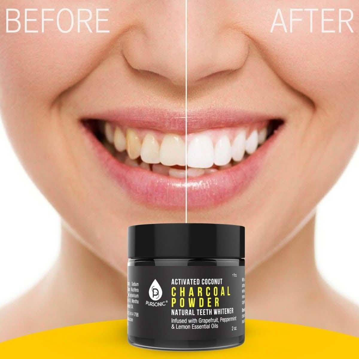 S520 Sonic Toothbrush - Accessories and Activated Coconut Charcoal Powder DailySale