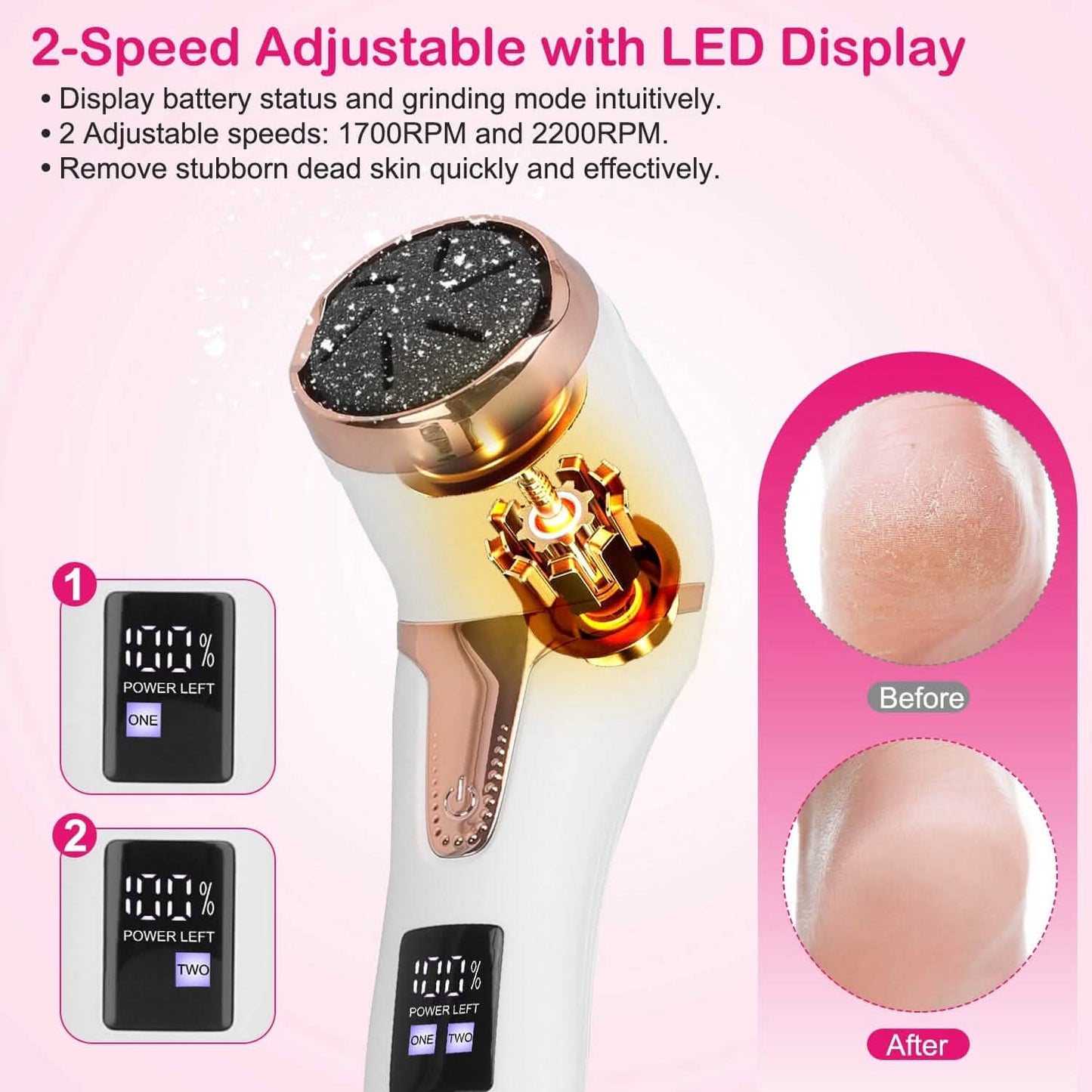 17-Pieces Set: Electric Foot Callus Remover with Vacuum Foot Grinder Rechargeable DailySale
