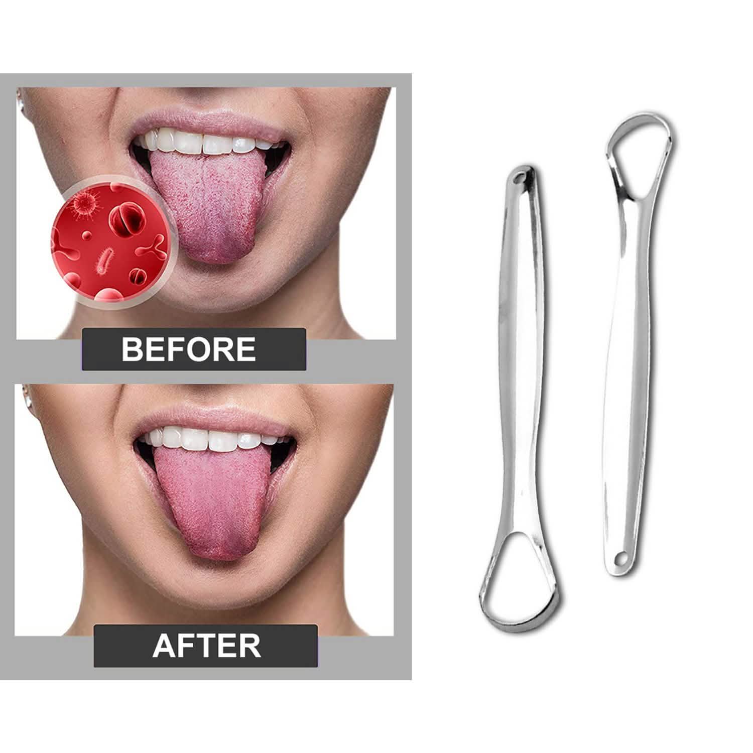 2-Pack: Stainless Steel Tongue Cleaner Scraper DailySale