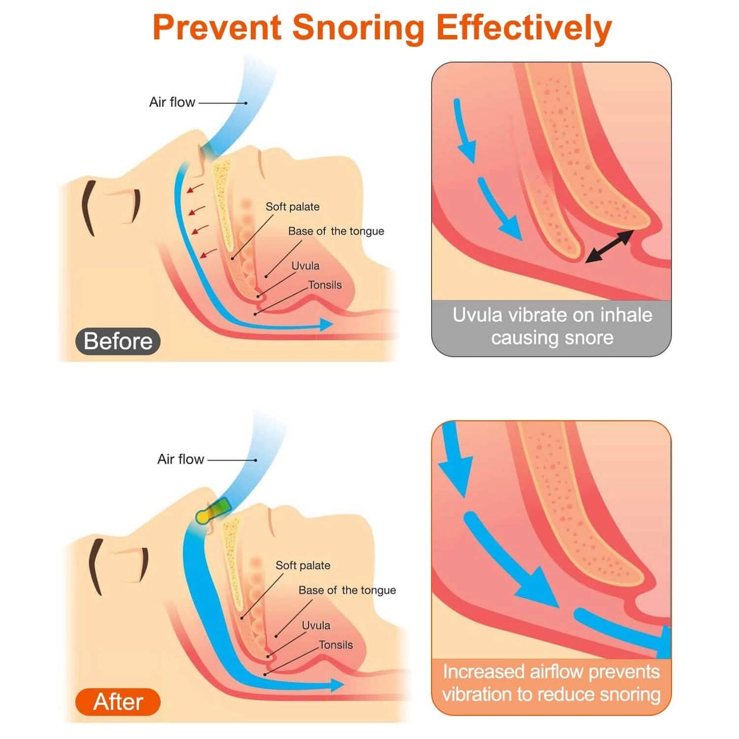 4-Pieces: Magnetic Nose Clip Anti Snoring Device DailySale