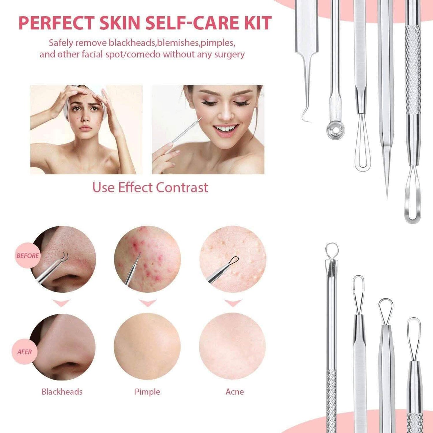 6-Pieces Set: Blackhead Remover Comedones Extractor Acne Removal Kit DailySale