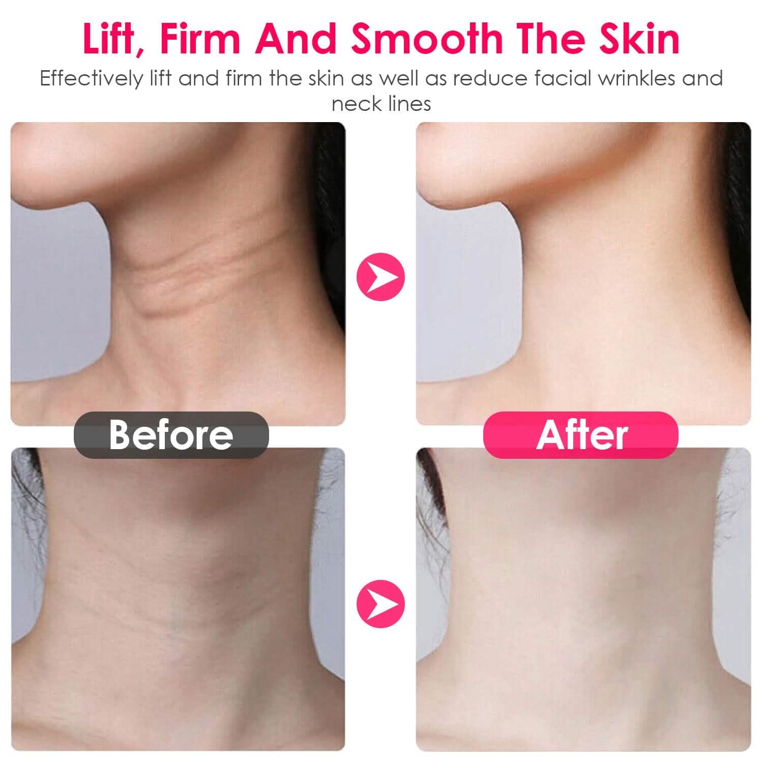 Anti Wrinkles Face Neck Massager Double Chin Reducer DailySale