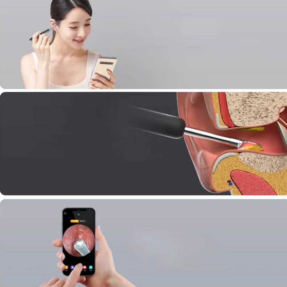 Bebird R1 Wireless Intelligent Visual Otoscope Ear Cleaner DailySale