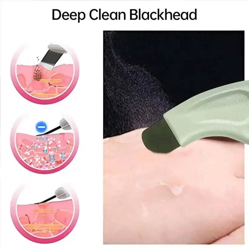 Blackhead Remover Tool Extractor DailySale