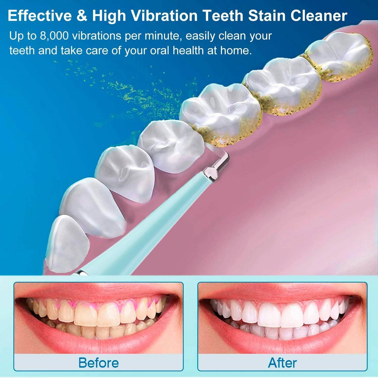 Electric Tartar Remover For Teeth DailySale