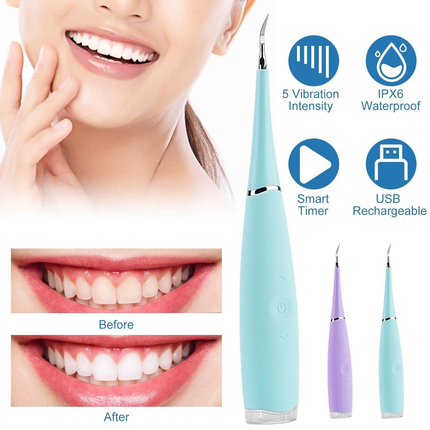 Electric Tartar Remover For Teeth DailySale