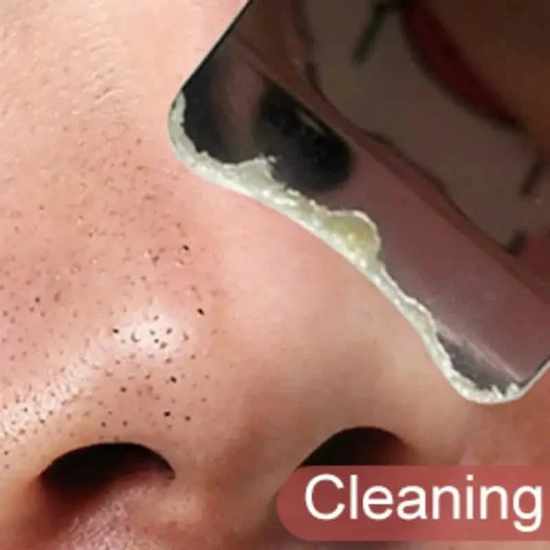 Facial Blackhead Removal Pore Cleaning Skin Scraper Tool DailySale