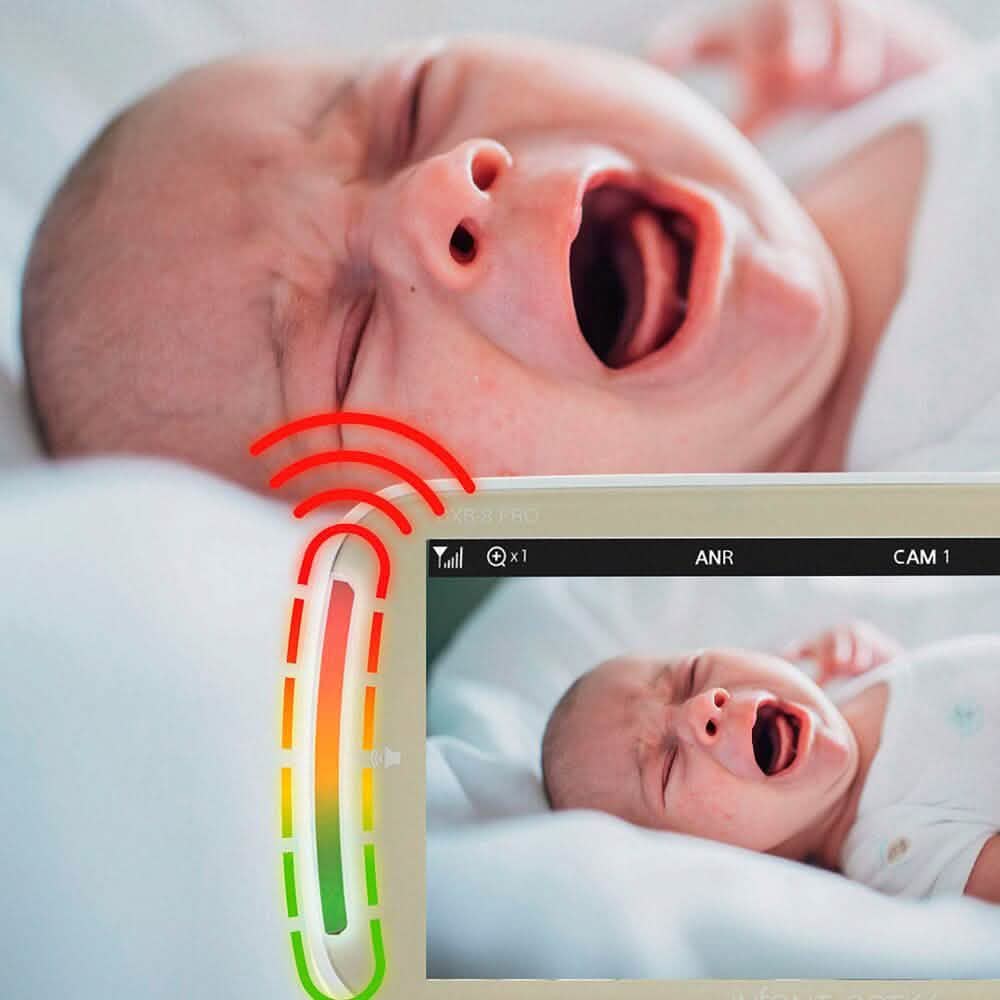 Infant Optics DXR-8 PRO Video Baby Monitor - White  (Refurbished) DailySale