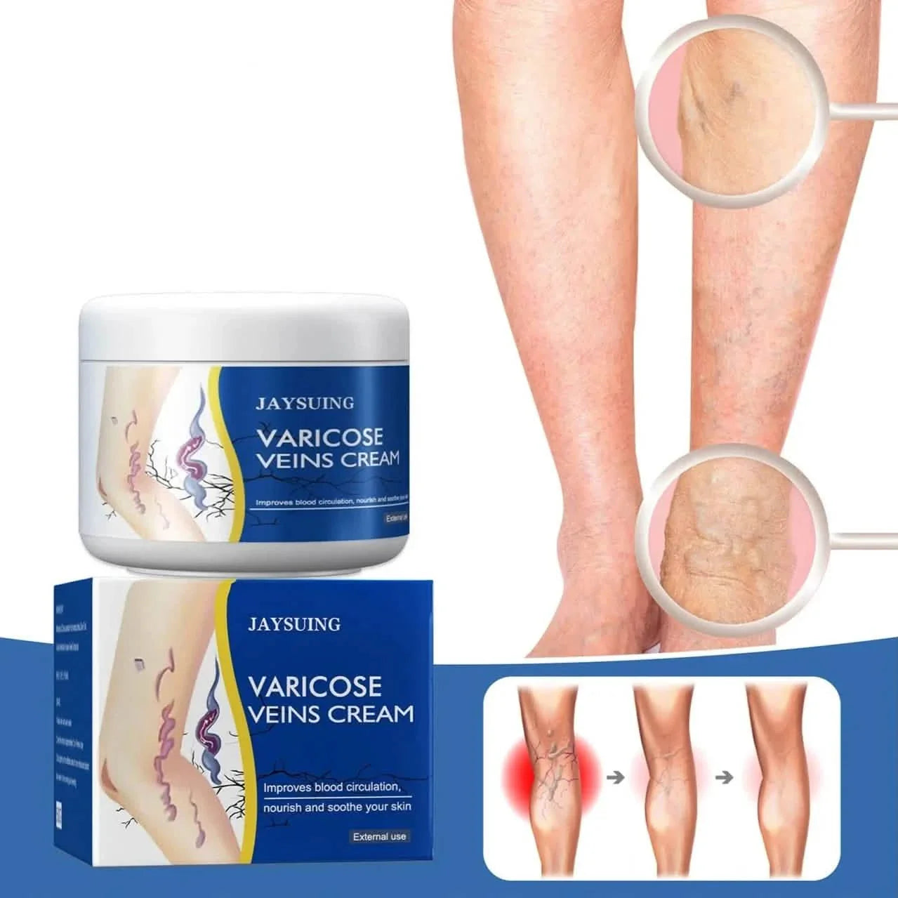 Pain Relief Leg Spider Veins Vasculitis Promote Circulation Smooth Metabolism 30g Exfoliation DailySale