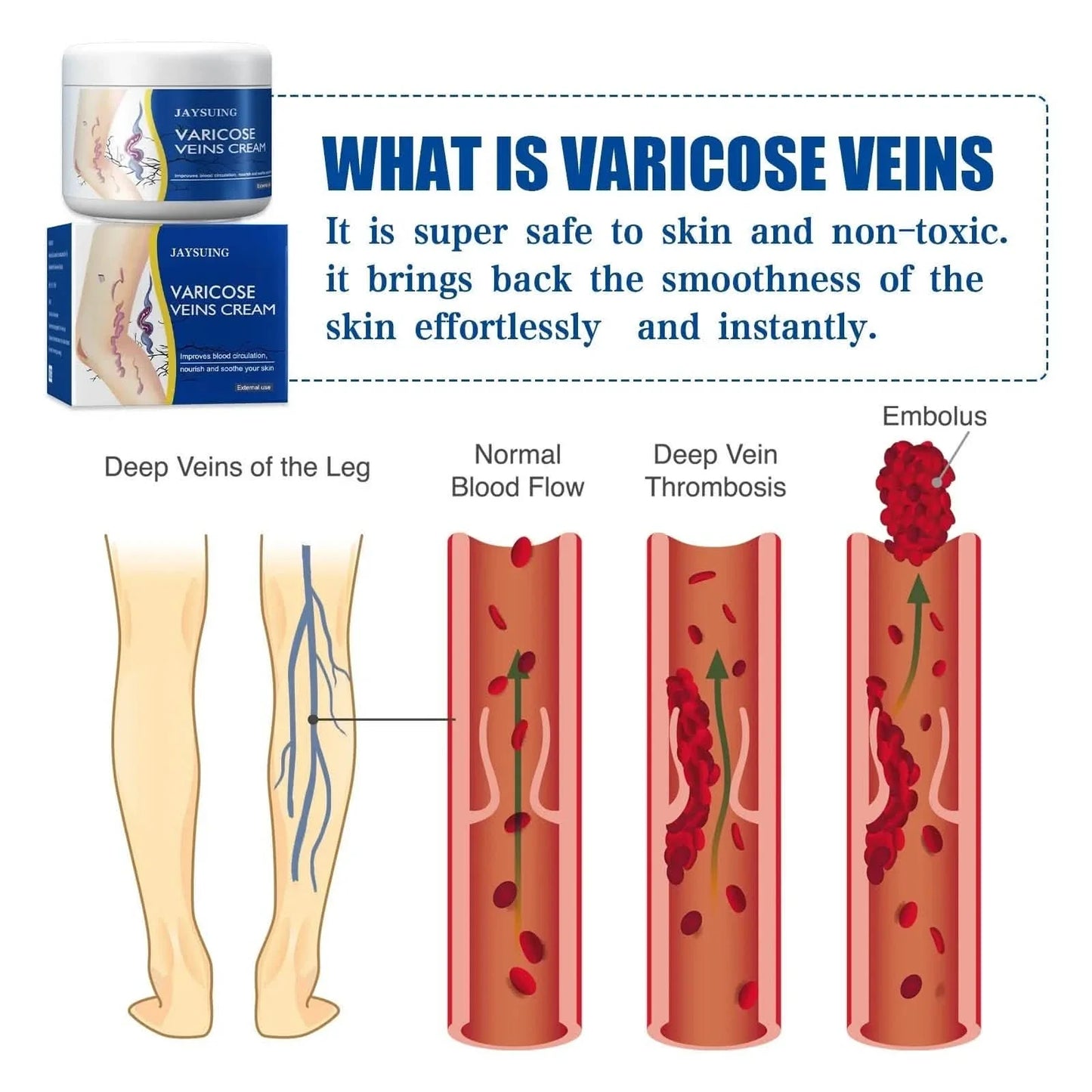 Pain Relief Leg Spider Veins Vasculitis Promote Circulation Smooth Metabolism 30g Exfoliation DailySale