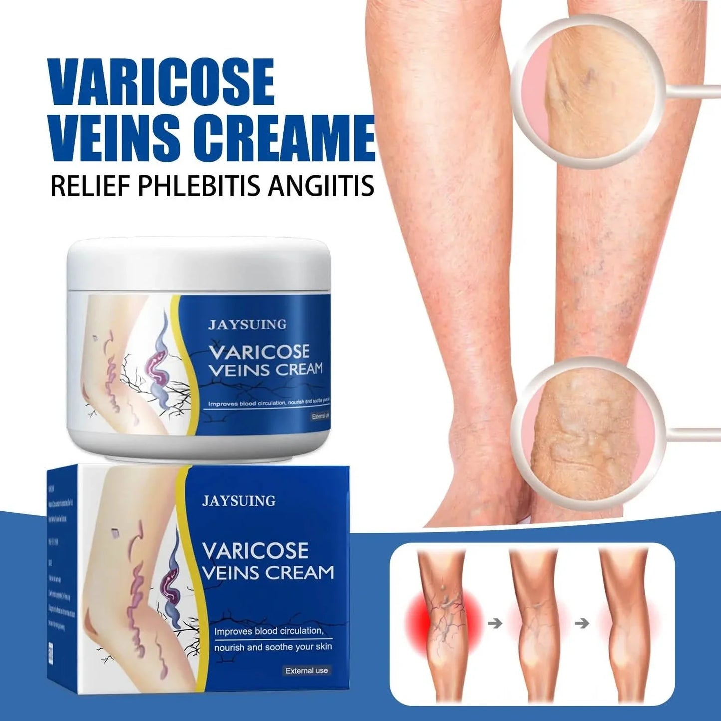 Pain Relief Leg Spider Veins Vasculitis Promote Circulation Smooth Metabolism 30g Exfoliation DailySale
