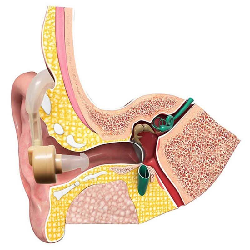 Personal Sound Amplifier Hearing Aid with Protective Case DailySale