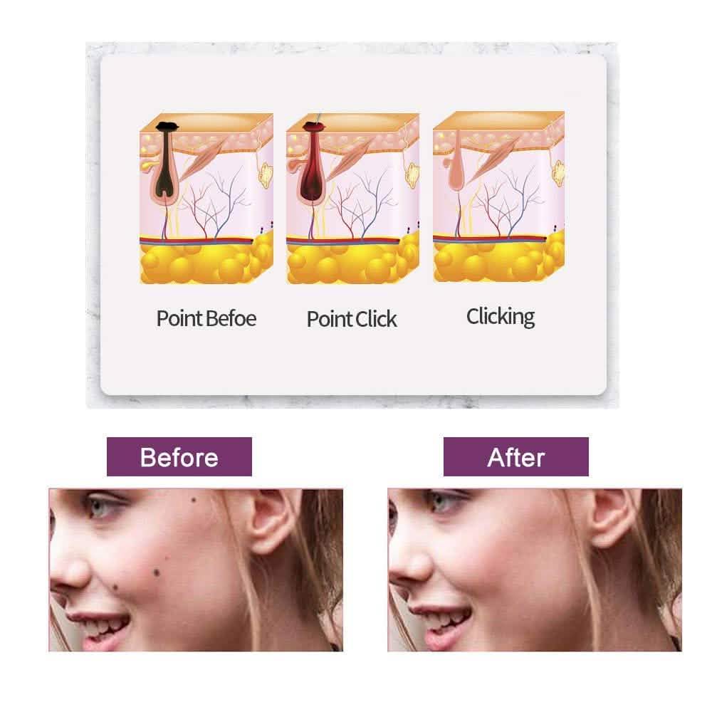 Portable Multi Level Beauty Equipment DailySale