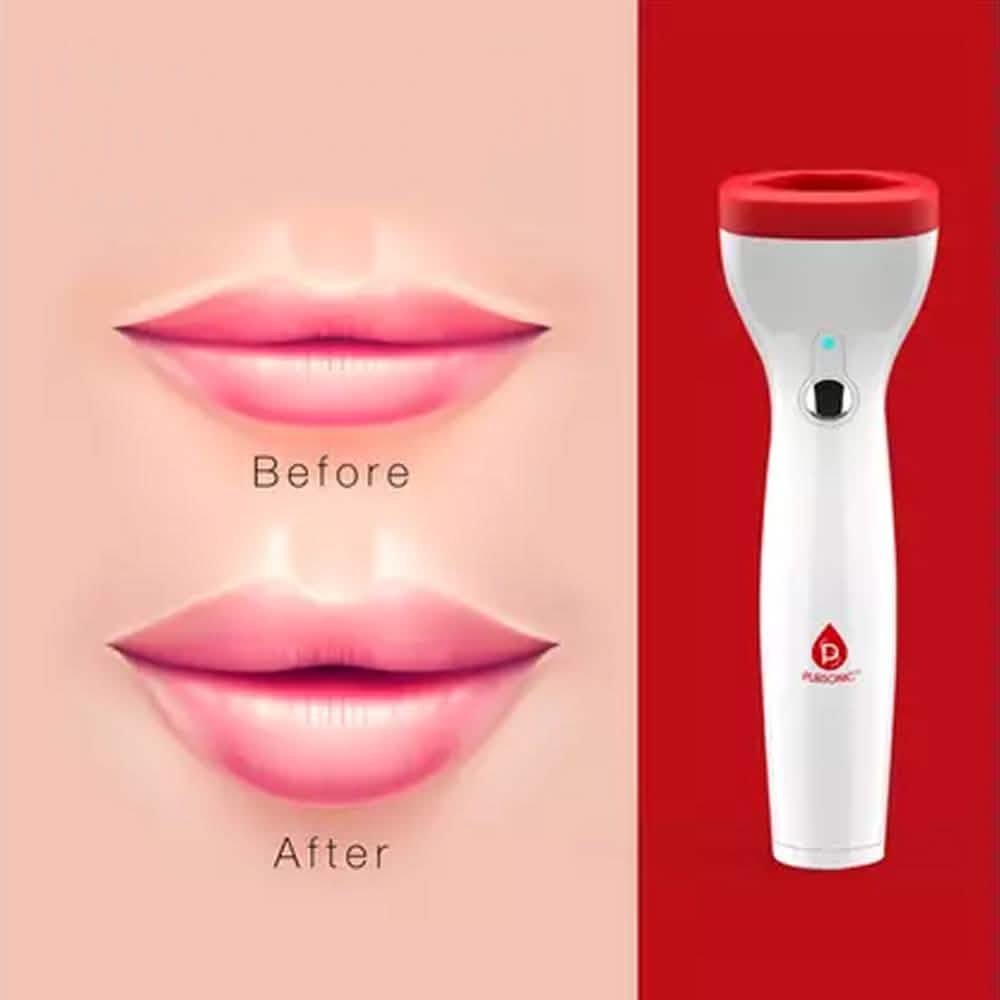 Pursonic Premium Automatic Fuller Lip Plumper DailySale