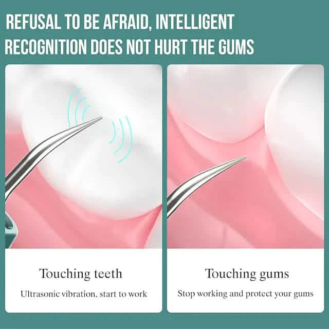 Visual Ultrasonic Teeth Cleaner DailySale